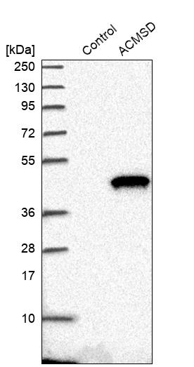 ACMSD Antibody - BSA Free Western Blot: ACMSD Antibody - BSA Free [NBP1-86480]