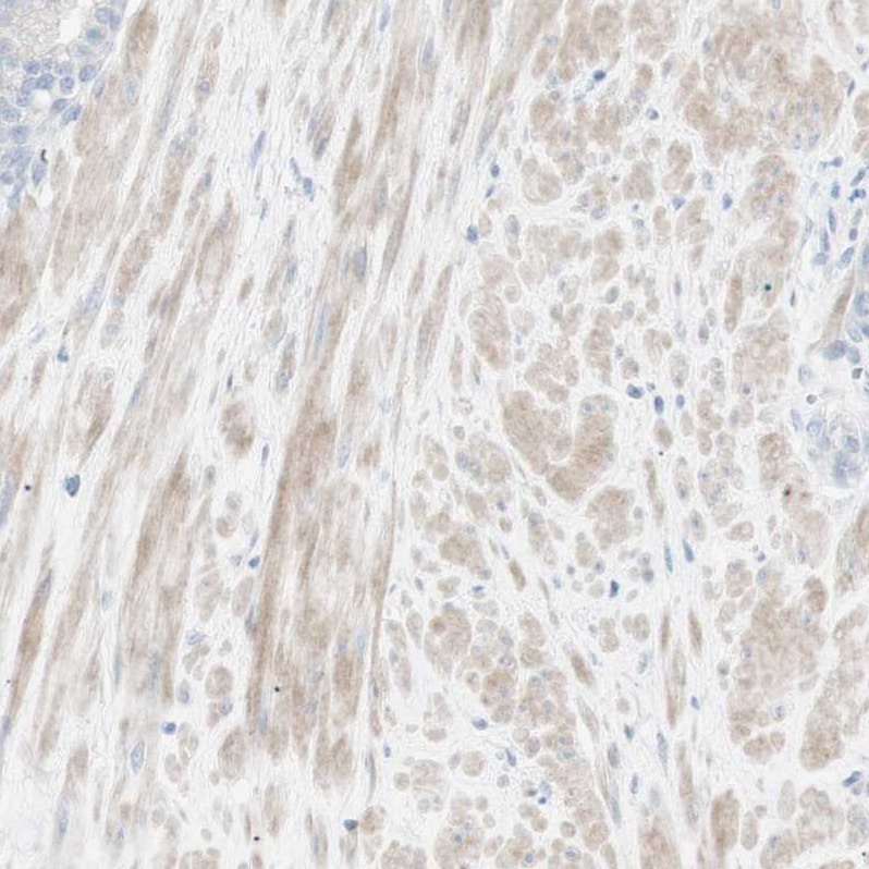 NDST4 Antibody - BSA Free Immunohistochemistry-Paraffin: NDST4 Antibody - BSA Free [NBP1-86481]