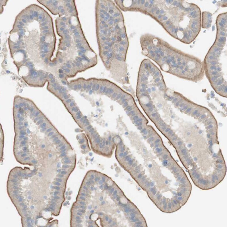 NDST4 Antibody - BSA Free Immunohistochemistry-Paraffin: NDST4 Antibody - BSA Free [NBP1-86481]