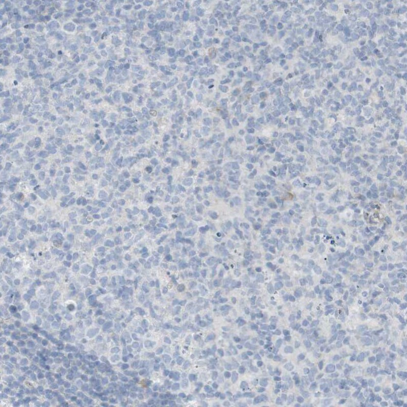 NDST4 Antibody - BSA Free Immunohistochemistry-Paraffin: NDST4 Antibody - BSA Free [NBP1-86481]