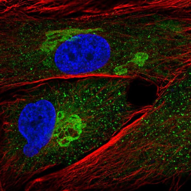 GALNT5 Antibody - BSA Free Immunocytochemistry/ Immunofluorescence: GALNT5 Antibody [NBP1-86483]