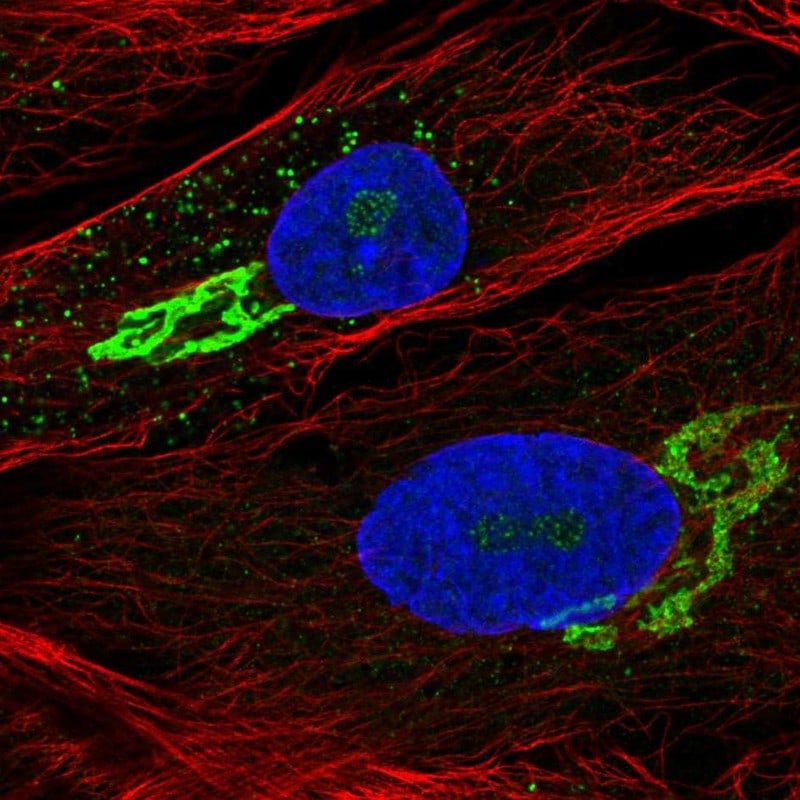 GALNT5 Antibody - BSA Free Immunocytochemistry/ Immunofluorescence: GALNT5 Antibody [NBP1-86484]