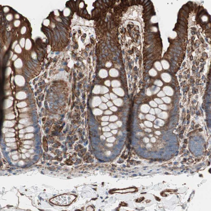 TCTA Antibody - BSA Free Immunohistochemistry-Paraffin: TCTA Antibody [NBP1-86497]