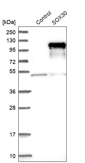 SOX30 Antibody - BSA Free Western Blot: SOX30 Antibody - BSA Free [NBP1-86503]