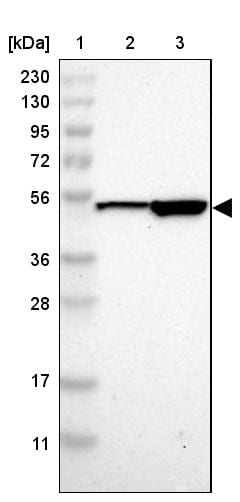 SOX30 Antibody - BSA Free Western Blot: SOX30 Antibody - BSA Free [NBP1-86503]