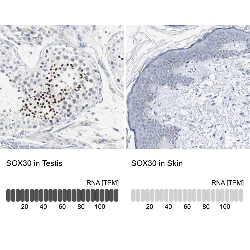 SOX30 Antibody - BSA Free Immunohistochemistry-Paraffin: SOX30 Antibody - BSA Free [NBP1-86503]