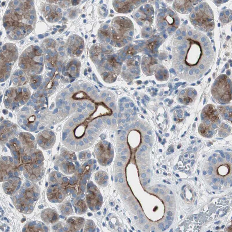 pIgR Antibody - BSA Free Immunohistochemistry-Paraffin: pIgR Antibody - BSA Free [NBP1-86504]