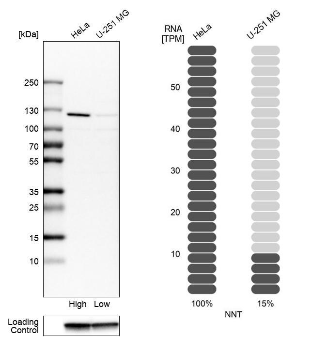 NNT Antibody - BSA Free Western Blot: NNT Antibody - BSA Free [NBP1-86512]