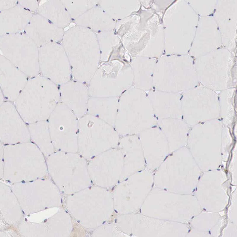 Aminopeptidase P2/XPNPEP2 Antibody - BSA Free Immunohistochemistry-Paraffin: Aminopeptidase P2/XPNPEP2 Antibody - BSA Free [NBP1-86535]