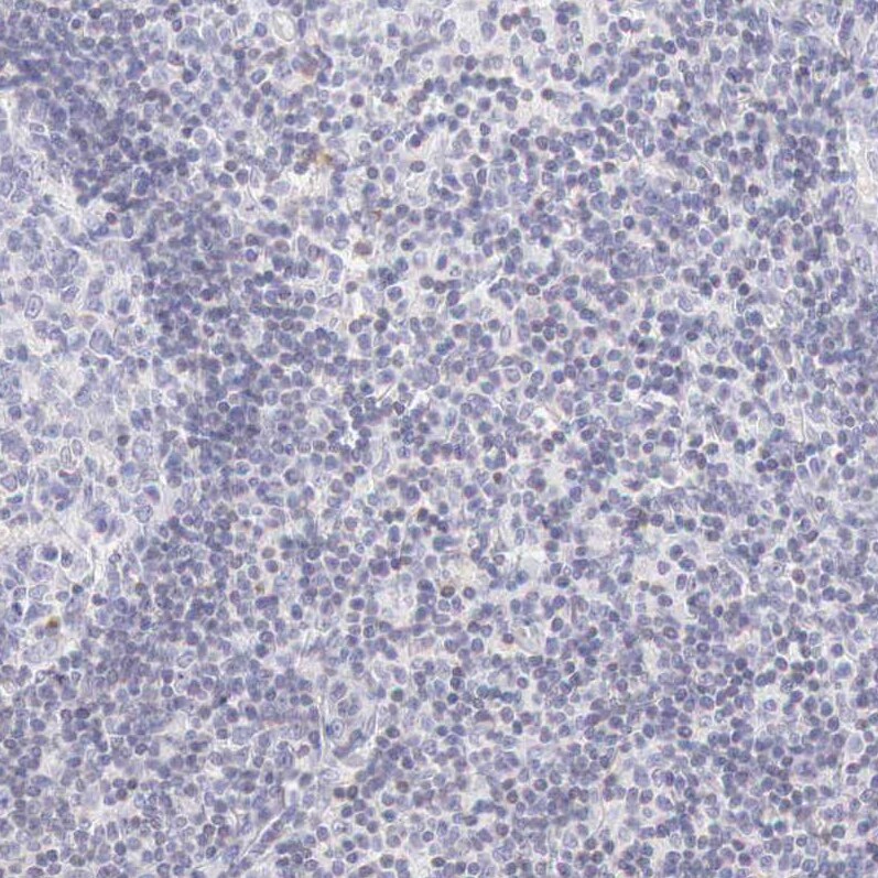 Aminopeptidase P2/XPNPEP2 Antibody - BSA Free Immunohistochemistry-Paraffin: Aminopeptidase P2/XPNPEP2 Antibody - BSA Free [NBP1-86535]