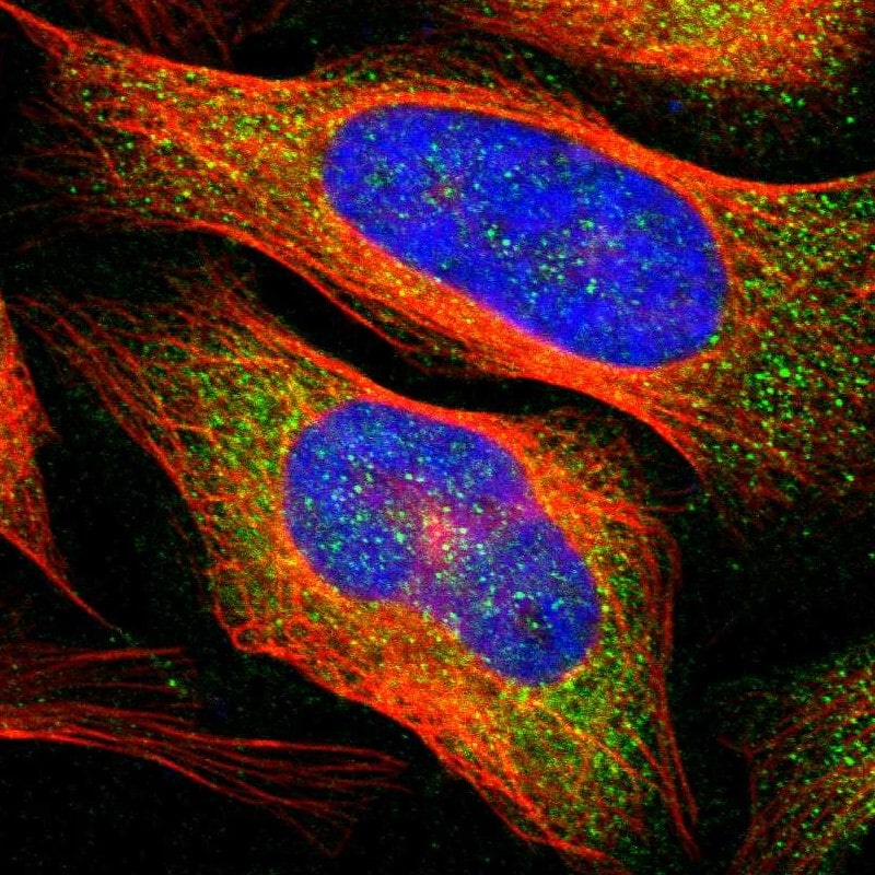 TACE/ADAM17 Antibody - BSA Free Immunohistochemistry-Paraffin: TACE/ADAM17 Antibody - BSA Free [NBP1-86546]