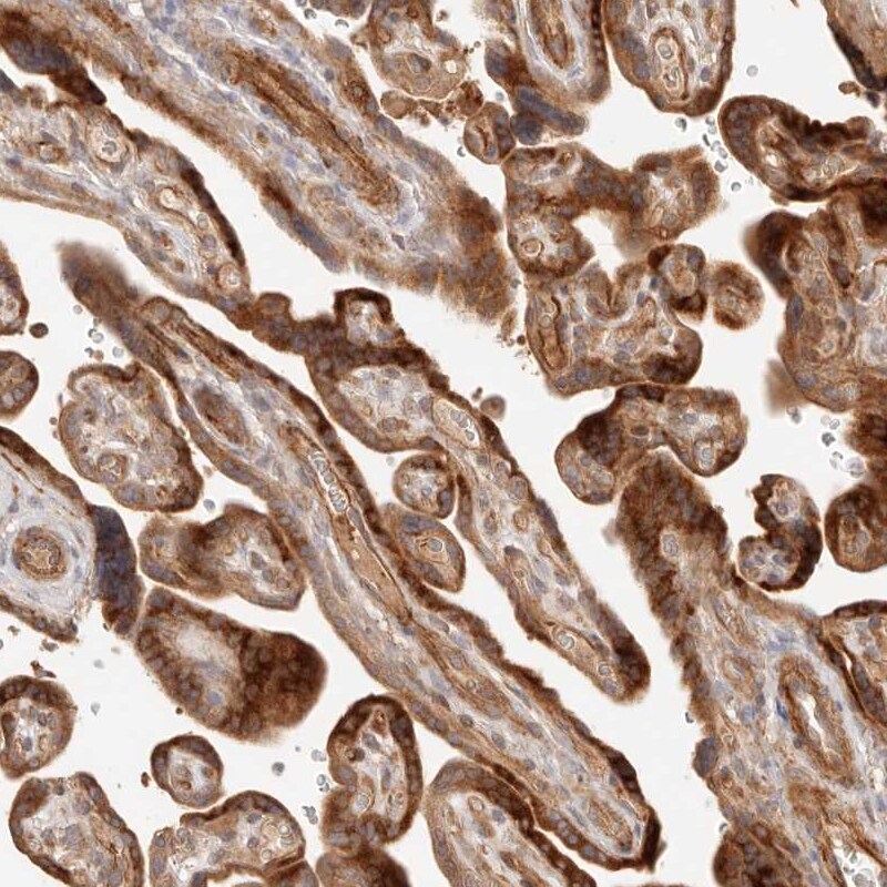 IL-1 RII Antibody - BSA Free Immunohistochemistry-Paraffin: IL-1 RII Antibody [NBP1-86550]