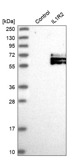 IL-1 RII Antibody - BSA Free Western Blot: IL-1 RII Antibody - BSA Free [NBP1-86550]