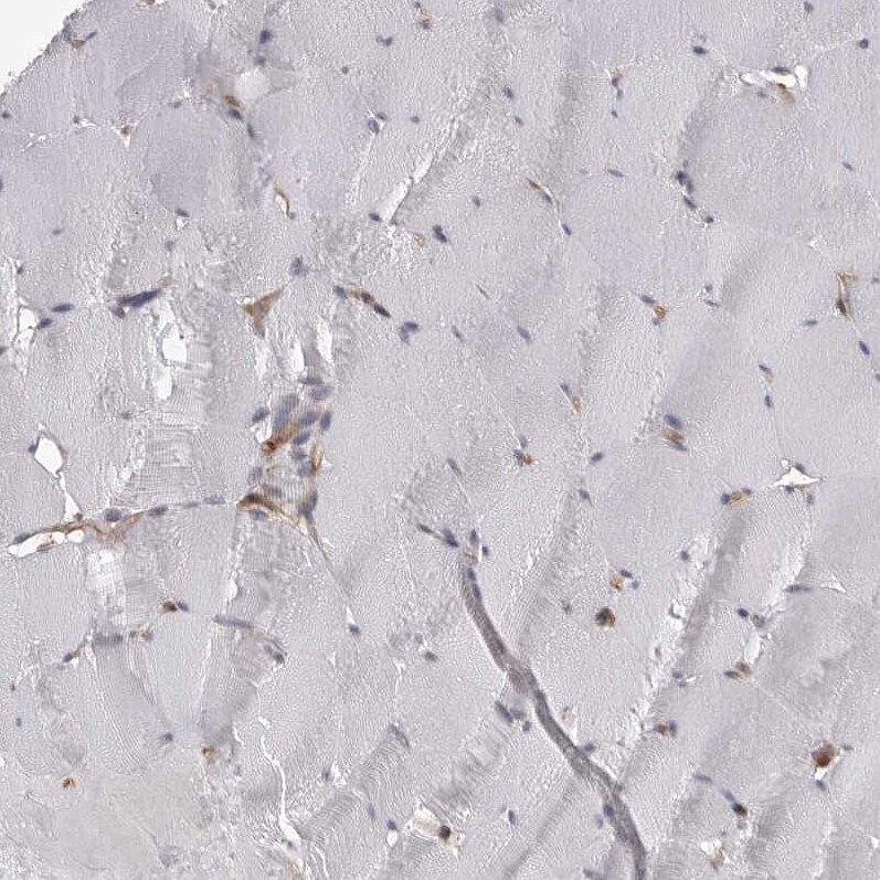 Nectin-1/PVRL1 Antibody - BSA Free Immunohistochemistry-Paraffin: Nectin-1/PVRL1 Antibody - BSA Free [NBP1-86554]