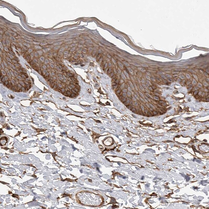 Nectin-1/PVRL1 Antibody - BSA Free Immunohistochemistry-Paraffin: Nectin-1/PVRL1 Antibody - BSA Free [NBP1-86554]