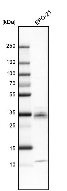 CTGF/CCN2 Antibody - BSA Free Western Blot: CTGF/CCN2 Antibody - BSA Free [NBP1-86571]