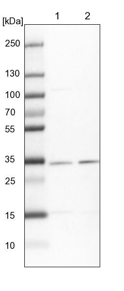 HCCS Antibody - BSA Free Western Blot: HCCS Antibody - BSA Free [NBP1-86577]