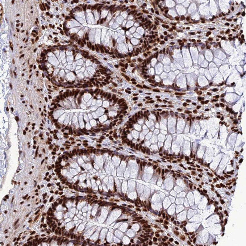 INO80E Antibody - BSA Free Immunohistochemistry-Paraffin: INO80E Antibody - BSA Free [NBP1-86578]