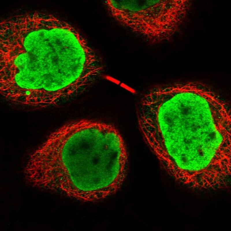 INO80E Antibody - BSA Free Immunohistochemistry-Paraffin: INO80E Antibody - BSA Free [NBP1-86578]