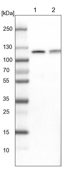 CBL Antibody - BSA Free Western Blot: CBL Antibody - BSA Free [NBP1-86588]
