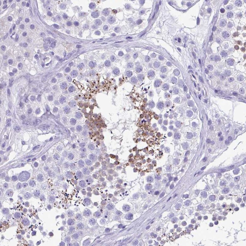 SPERT Antibody - BSA Free Immunohistochemistry-Paraffin: SPERT Antibody - BSA Free [NBP1-86593]