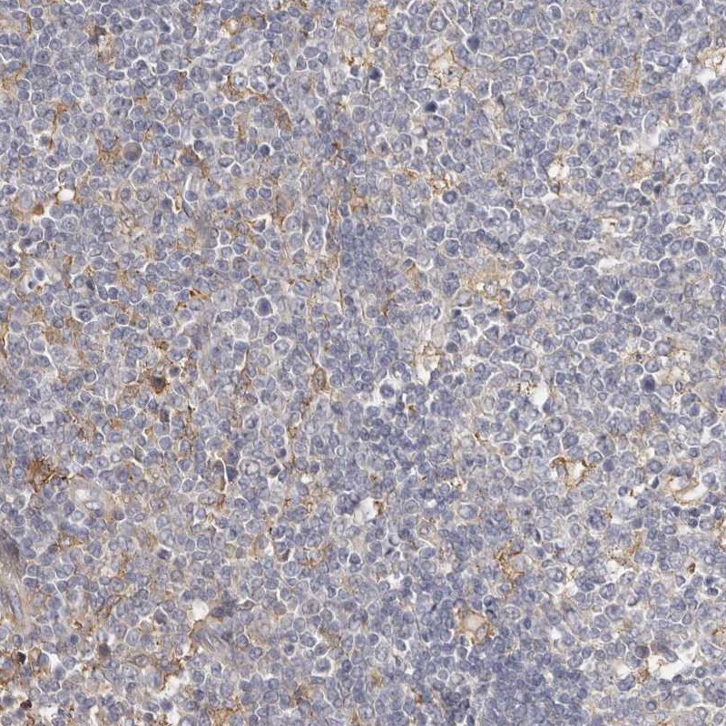 MSRB2 Antibody - BSA Free Immunohistochemistry-Paraffin: MSRB2 Antibody - BSA Free [NBP1-86594]