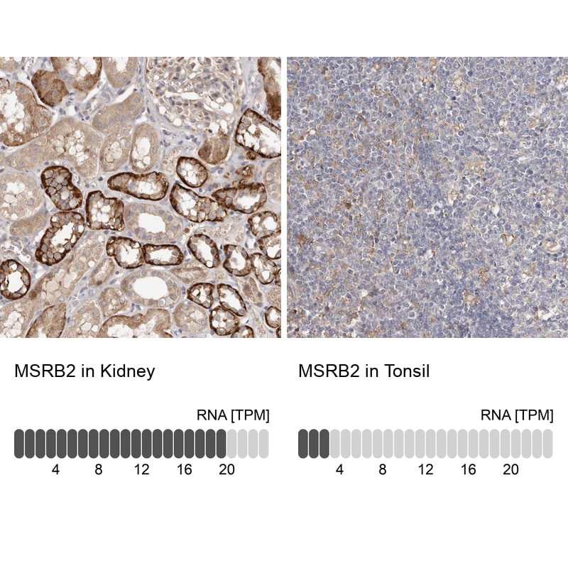 MSRB2 Antibody - BSA Free Immunohistochemistry-Paraffin: MSRB2 Antibody - BSA Free [NBP1-86594]