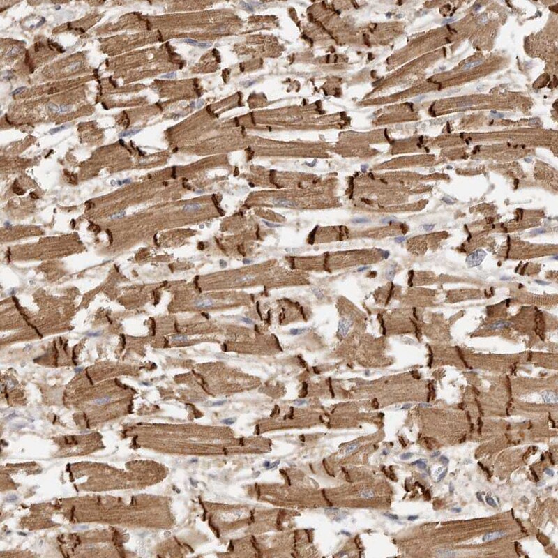 MSRB2 Antibody - BSA Free Immunohistochemistry-Paraffin: MSRB2 Antibody - BSA Free [NBP1-86594]