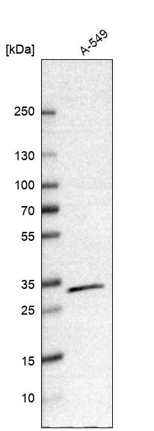 CBR1 Antibody - BSA Free Western Blot: CBR1 Antibody - BSA Free [NBP1-86595]