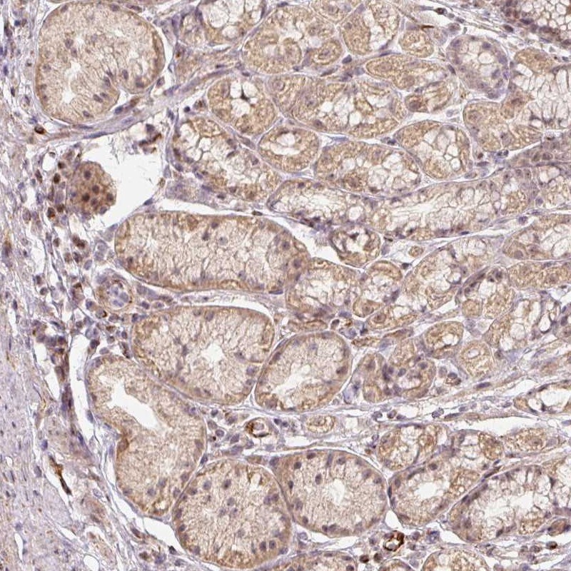 MMACHC Antibody - BSA Free Immunohistochemistry-Paraffin: MMACHC Antibody [NBP1-86598]