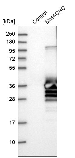 MMACHC Antibody - BSA Free Western Blot: MMACHC Antibody - BSA Free [NBP1-86598]