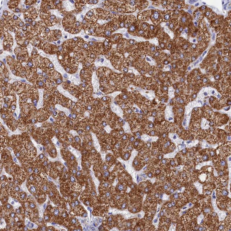 MMAB Antibody - BSA Free Immunohistochemistry-Paraffin: MMAB Antibody - BSA Free [NBP1-86602]