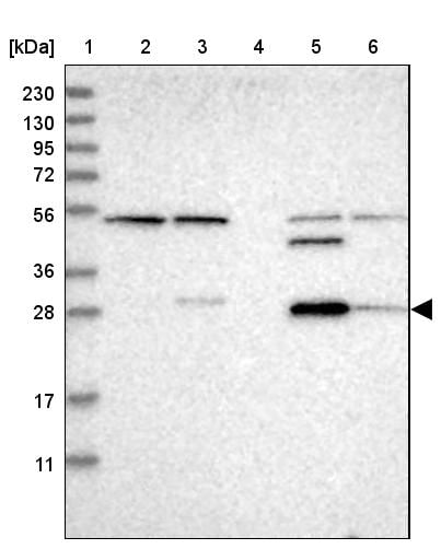 Carbonic Anhydrase XIII/CA13 Antibody - BSA Free Western Blot: Carbonic Anhydrase XIII/CA13 Antibody - BSA Free [NBP1-86606]