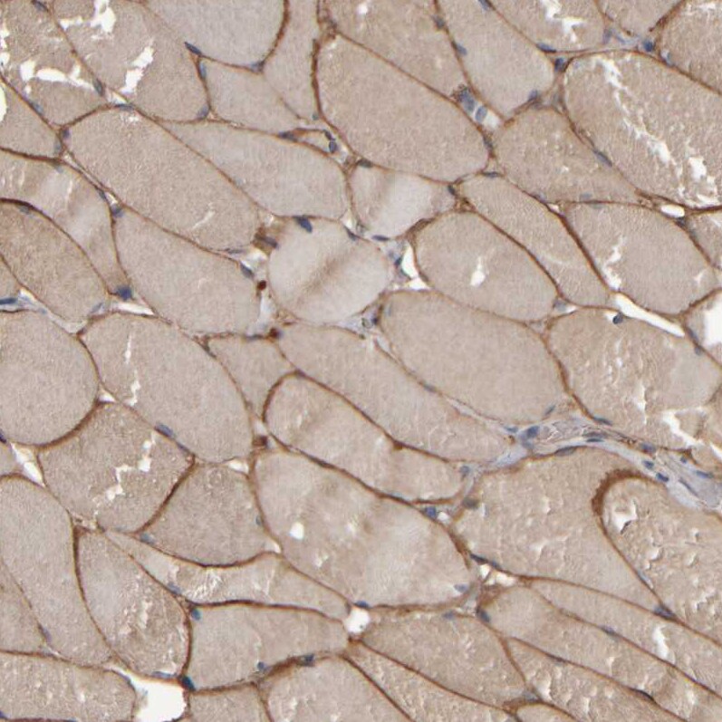 MURC Antibody - BSA Free Immunohistochemistry-Paraffin: MURC Antibody - BSA Free [NBP1-86607]