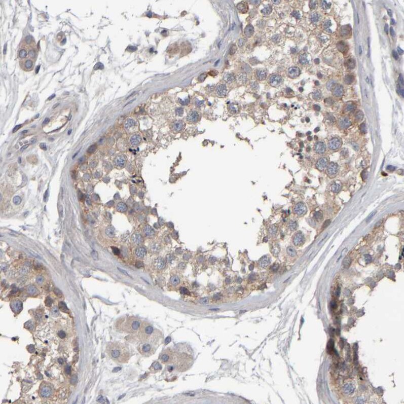 MURC Antibody - BSA Free Immunohistochemistry-Paraffin: MURC Antibody - BSA Free [NBP1-86607]