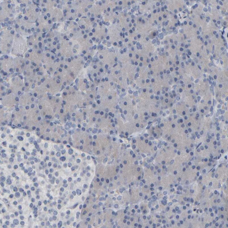 MURC Antibody - BSA Free Immunohistochemistry-Paraffin: MURC Antibody - BSA Free [NBP1-86607]