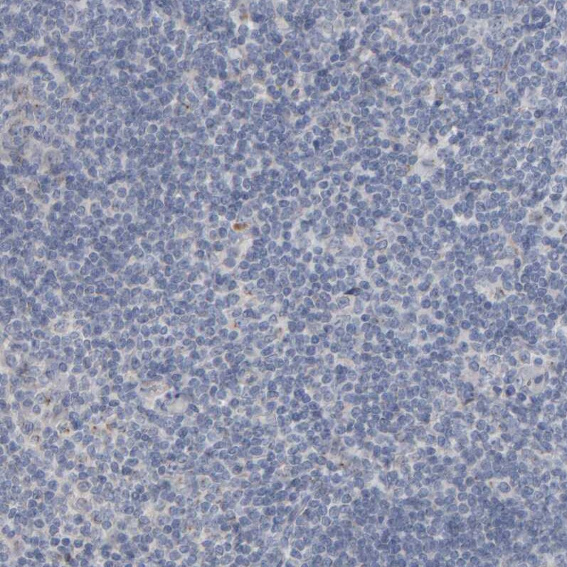 MURC Antibody - BSA Free Immunohistochemistry-Paraffin: MURC Antibody - BSA Free [NBP1-86607]