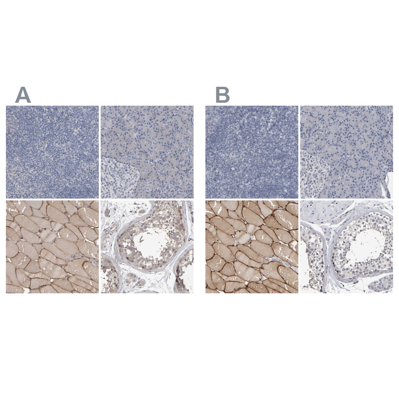 MURC Antibody - BSA Free Immunohistochemistry-Paraffin: MURC Antibody - BSA Free [NBP1-86607]