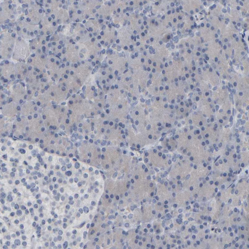 MURC Antibody - BSA Free Immunohistochemistry-Paraffin: MURC Antibody - BSA Free [NBP1-86607]