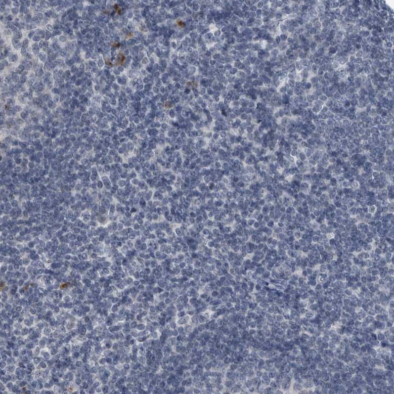MURC Antibody - BSA Free Immunohistochemistry-Paraffin: MURC Antibody - BSA Free [NBP1-86608]