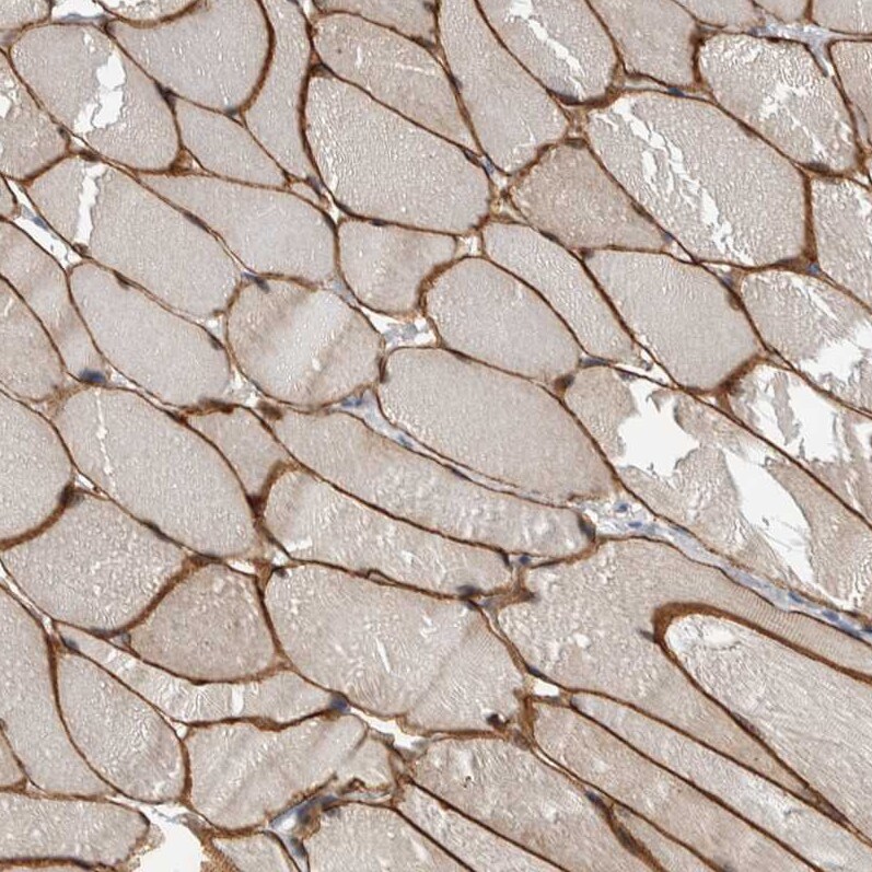 MURC Antibody - BSA Free Immunohistochemistry-Paraffin: MURC Antibody - BSA Free [NBP1-86608]
