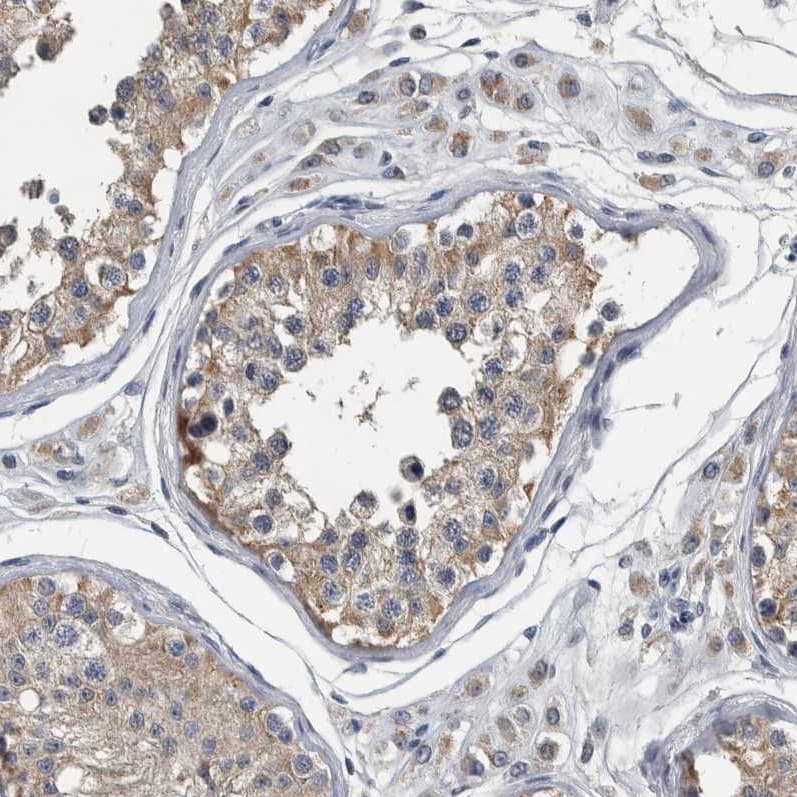 MURC Antibody - BSA Free Immunohistochemistry-Paraffin: MURC Antibody - BSA Free [NBP1-86608]