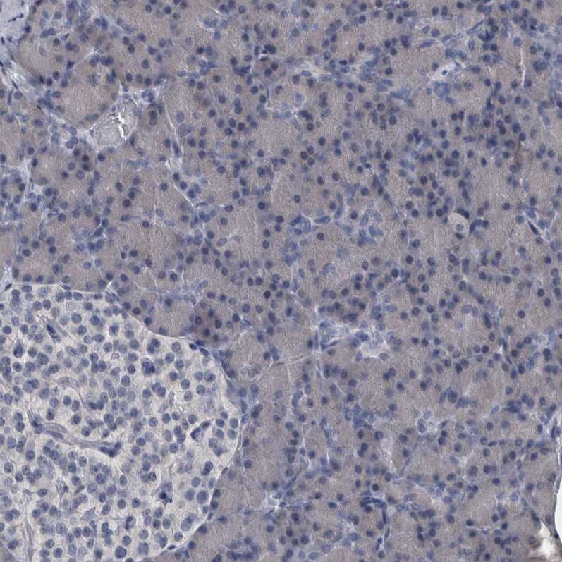MURC Antibody - BSA Free Immunohistochemistry-Paraffin: MURC Antibody - BSA Free [NBP1-86608]