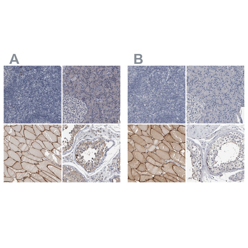 MURC Antibody - BSA Free Immunohistochemistry-Paraffin: MURC Antibody - BSA Free [NBP1-86608]