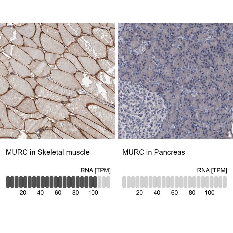 MURC Antibody - BSA Free Immunohistochemistry-Paraffin: MURC Antibody - BSA Free [NBP1-86608]