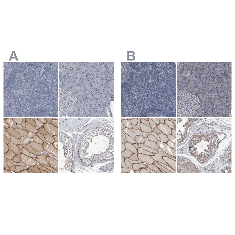 MURC Antibody - BSA Free Immunohistochemistry-Paraffin: MURC Antibody - BSA Free [NBP1-86609]