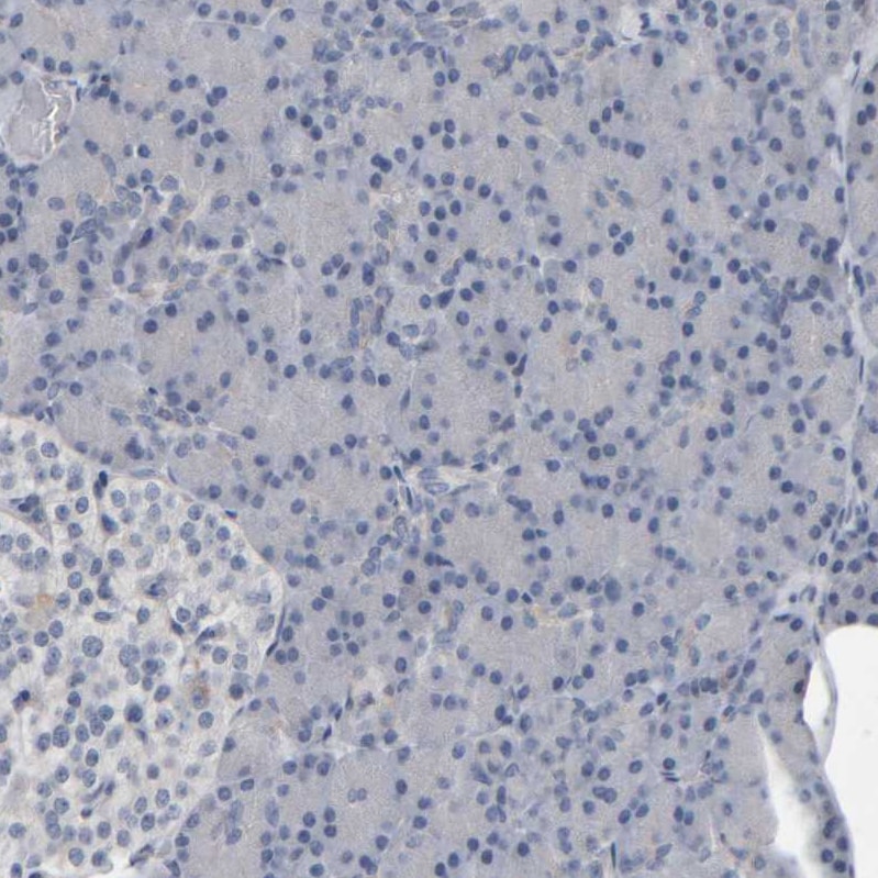 MURC Antibody - BSA Free Immunohistochemistry-Paraffin: MURC Antibody - BSA Free [NBP1-86609]