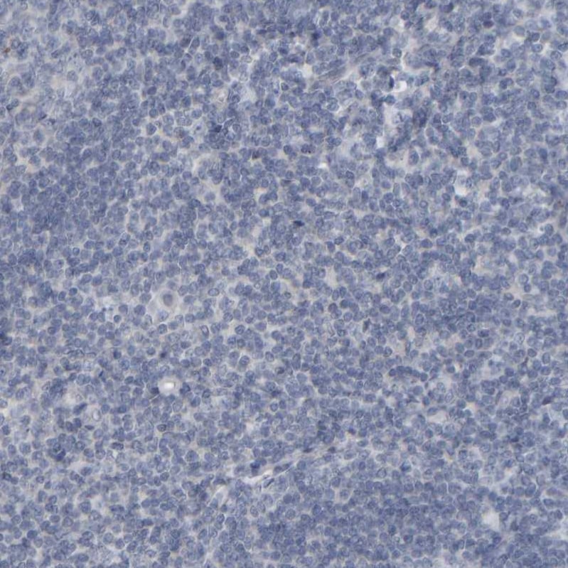 MURC Antibody - BSA Free Immunohistochemistry-Paraffin: MURC Antibody - BSA Free [NBP1-86609]