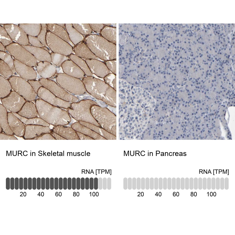 MURC Antibody - BSA Free Immunohistochemistry-Paraffin: MURC Antibody - BSA Free [NBP1-86609]