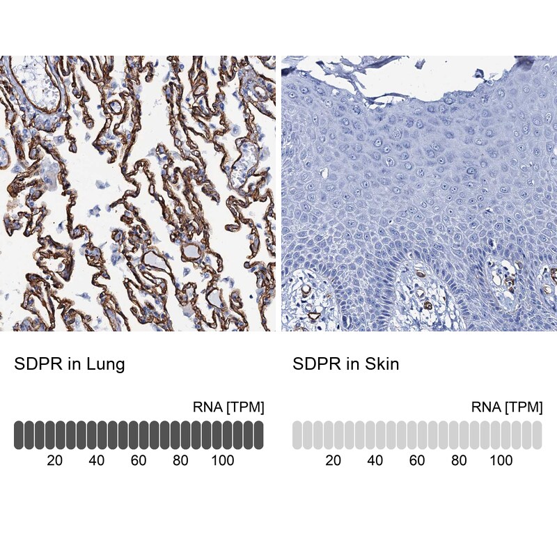 SDPR Antibody - BSA Free Immunohistochemistry-Paraffin: SDPR Antibody - BSA Free [NBP1-86610]